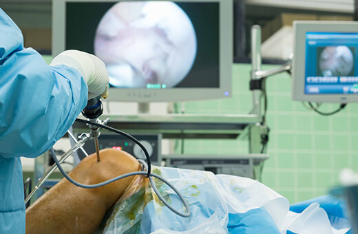 Rekonstrukcja ACL Poznań