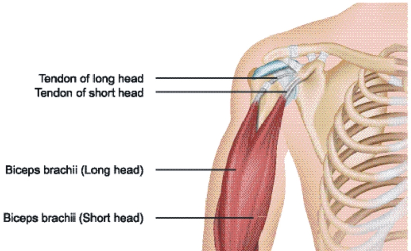 Patologia ścięgna głowy długiej bicepsa