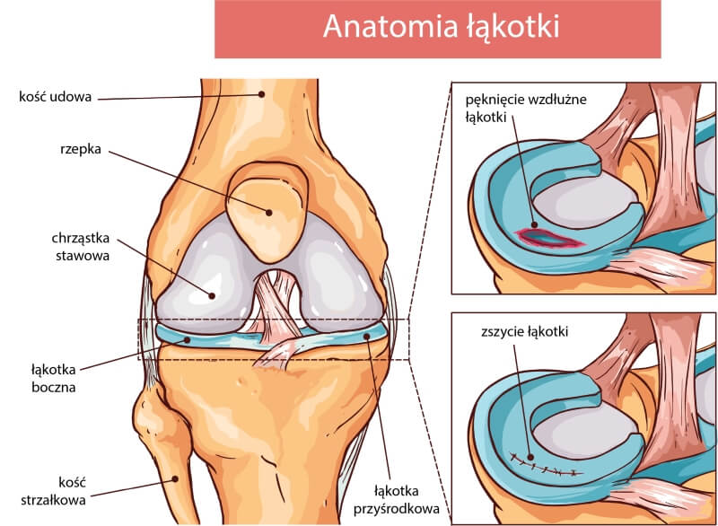 Anatomia łąkotki