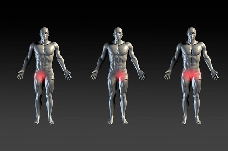 Ból w&nbsp;pachwinie