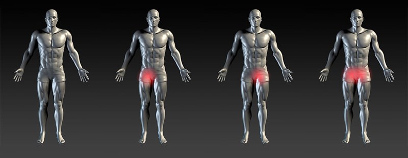 Ból w&nbsp;pachwinie