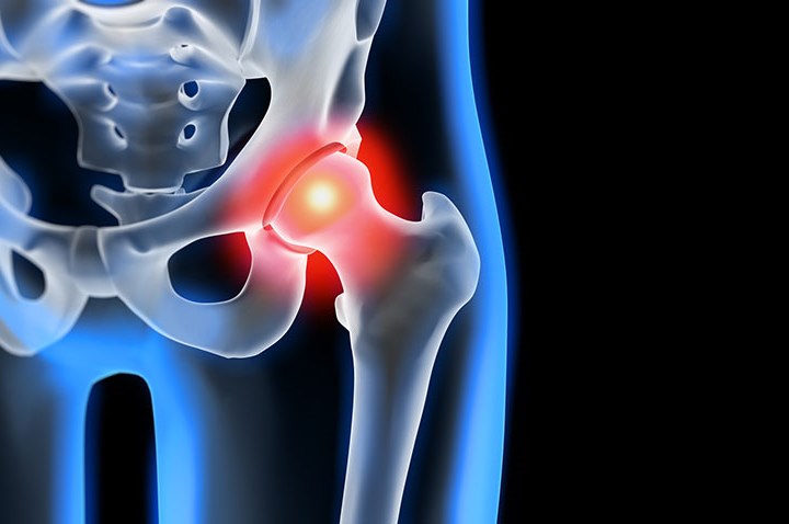 Artroskopia biodra