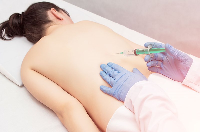 Ostrzyknięcie kręgosłupa