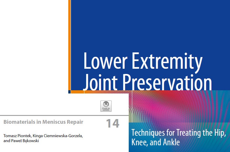 Artykuł ortopedów z&nbsp;Rehasport w&nbsp;najnowszej publikacji Springera