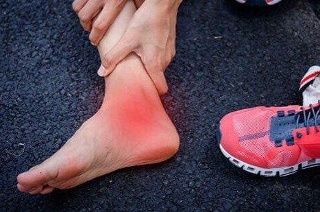 Skręcenie stawu skokowego