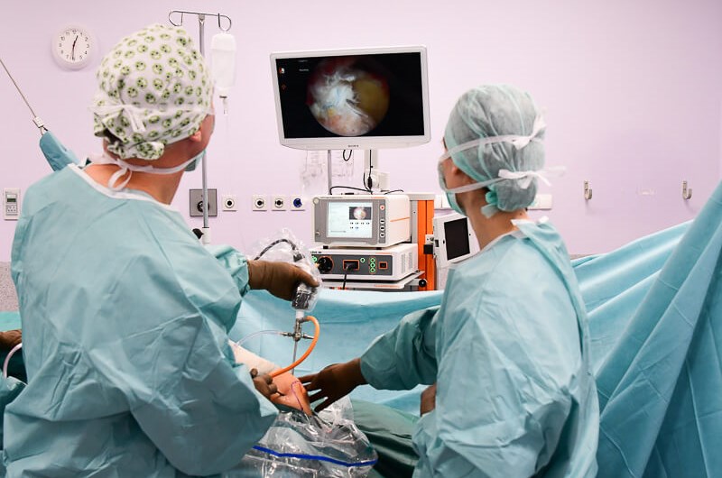Artroskopowa naprawa pierścienia rotatorów – jak przebiega operacja?