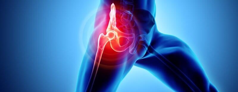 Ból biodra przy chodzeniu