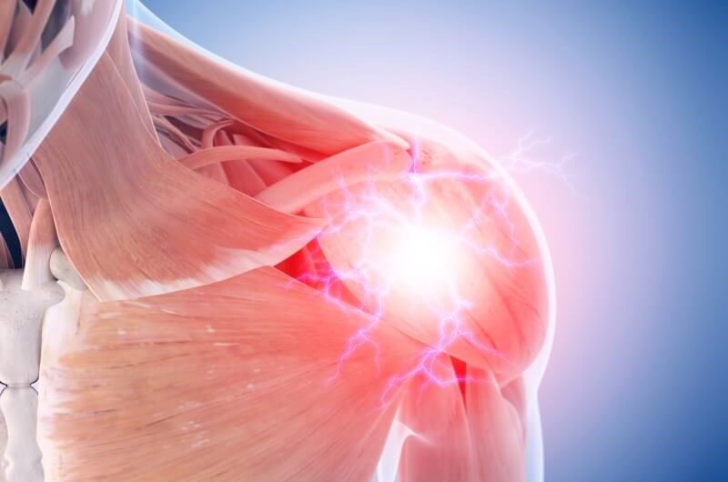 Ból barku – urazy stawu ramiennego