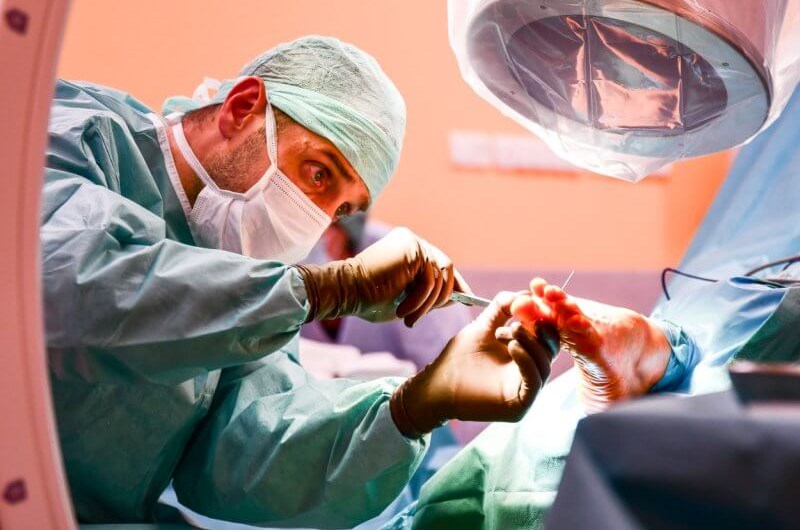 Operacja haluksa – jak przebiega operacja palucha koślawego