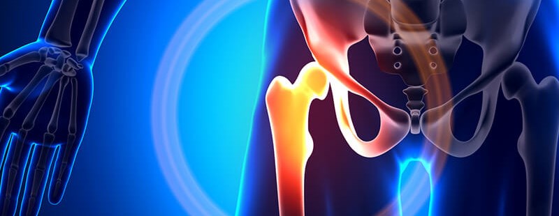 Hip joint endoprosthesis