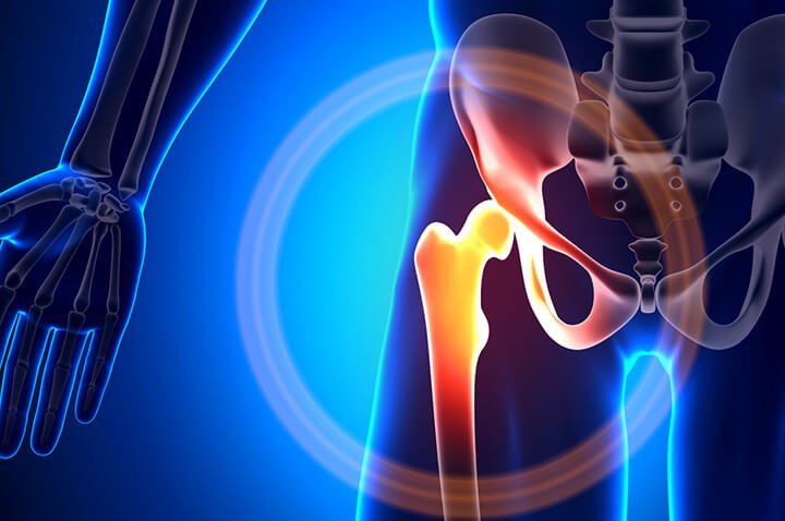 Hip joint endoprosthesis