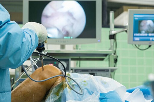 Anterior Cruciate Ligament (ACL) Injury