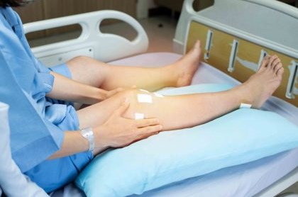 Posterior Cruciate Ligament (PCL)