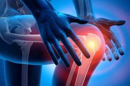 Patellar Dislocation