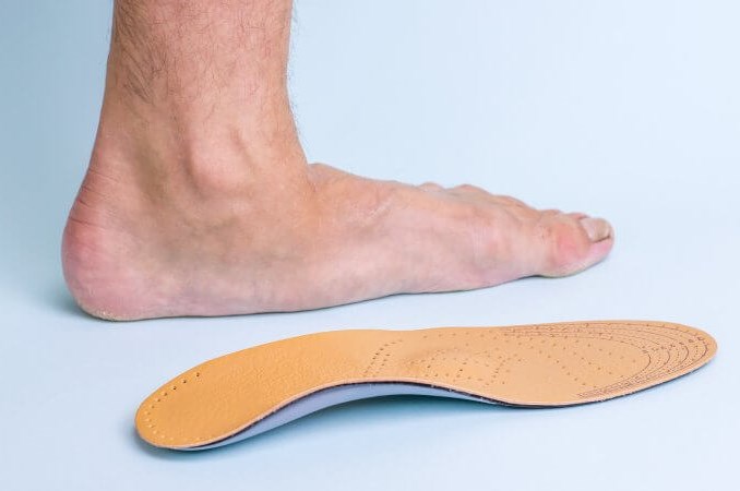 Flatfoot - Causes, Symptoms, Treatment, Exercises