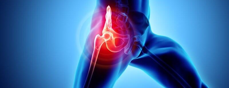 Hip Pain While Walking
