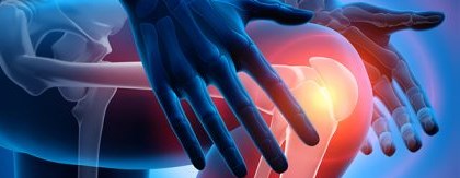 Patellar Dislocation