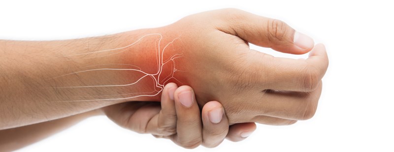 Carpal Tunnel Syndrome