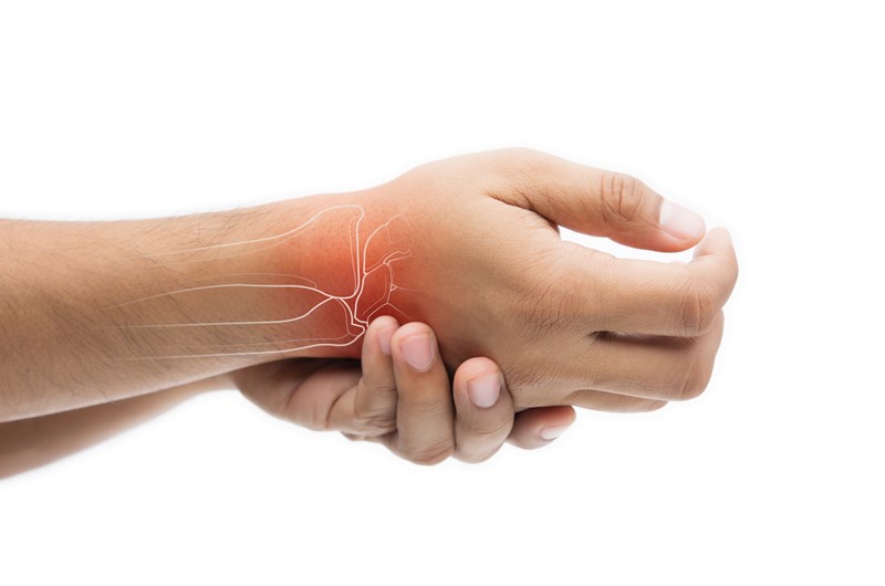 Carpal Tunnel Syndrome