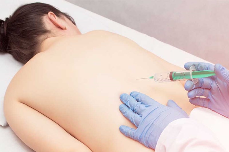 Spinal Injection