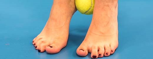 Exercises for hallux valgus