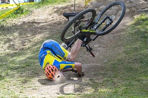 Fracture of the clavicle