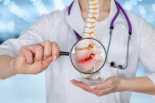 Spinal herniation