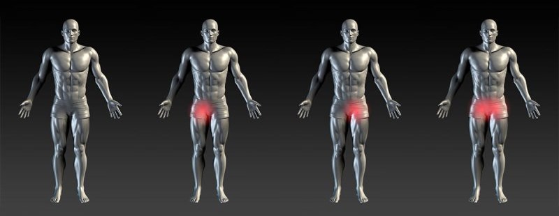 Groin pain