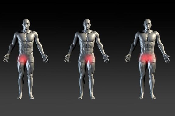 Groin pain