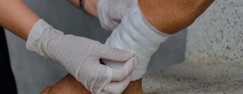 Treatment of Hard-to-Heal Wounds
