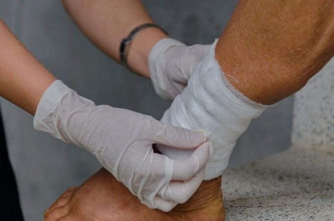 Treatment of Hard-to-Heal Wounds