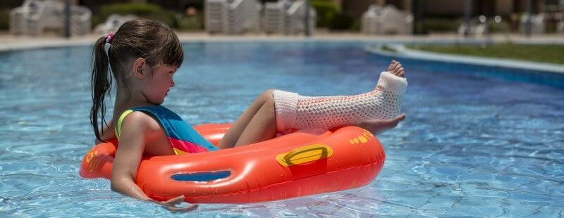 Innovative Use of Cast Material