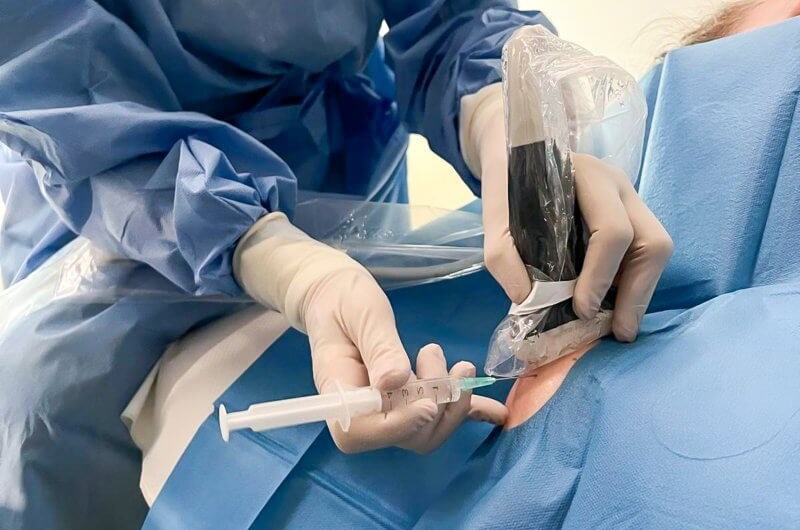 Sonochirurgia - nowa era w&nbsp;leczeniu dolegliwości stawowych