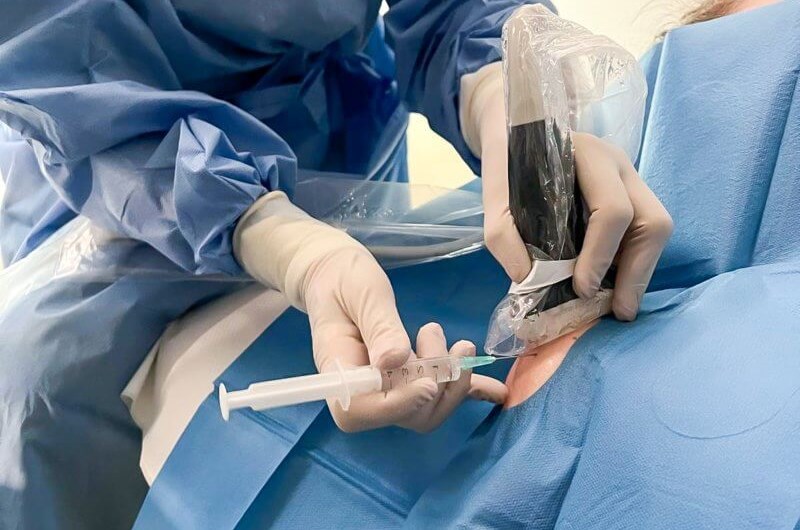 Sonosurgery – A&nbsp;New Era in the Treatment of Joint Disorders