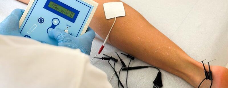 Percutaneous Electrolysis EPTE