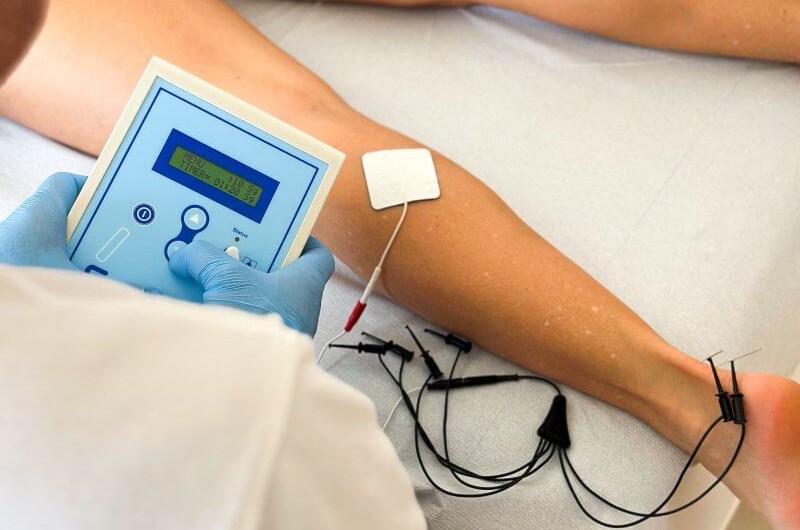 Percutaneous Electrolysis EPTE